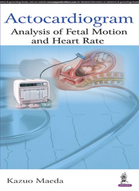 Actocardiogram : Analysis of Fetal Motion and Heart Rate, Paperback / softback Book