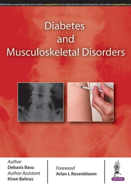 Diabetes and Musculoskeletal Disorders, Paperback / softback Book
