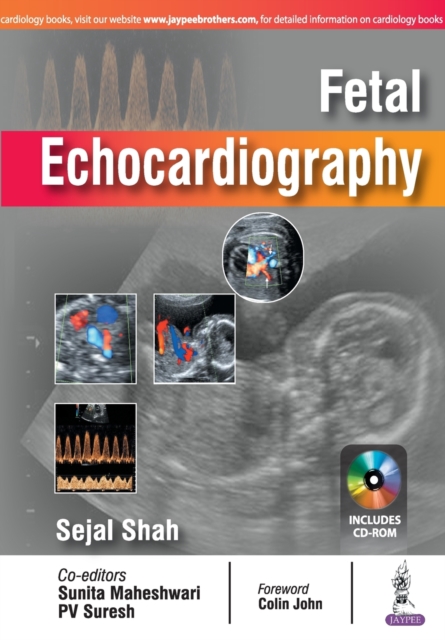 Fetal Echocardiography, Paperback / softback Book