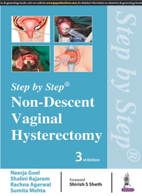 Step by Step: Non-Descent Vaginal Hysterectomy, Paperback / softback Book