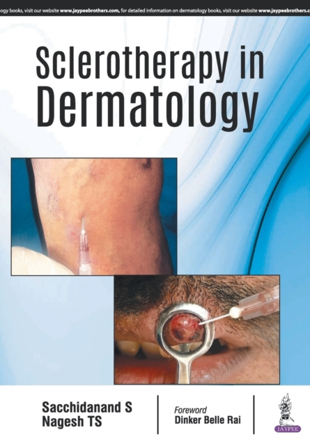 Sclerotherapy in Dermatology, Paperback / softback Book