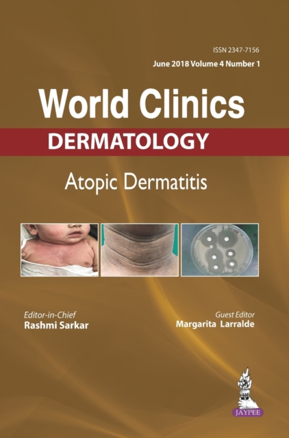 World Clinics: Dermatology : Atopic Dermatitis, Hardback Book