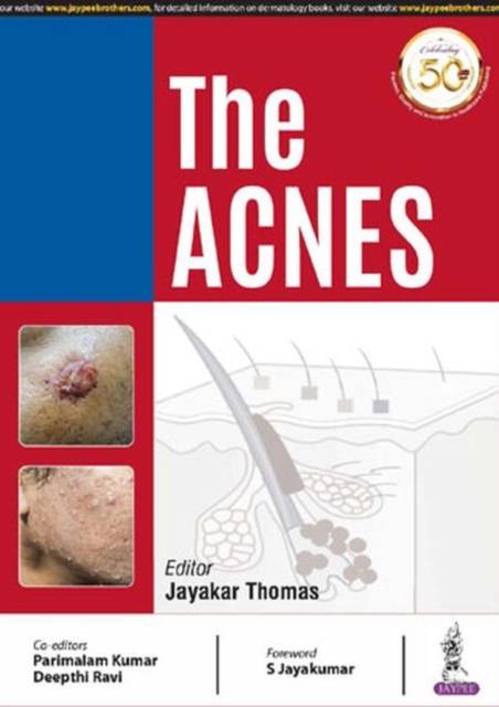 The Acnes, Paperback / softback Book