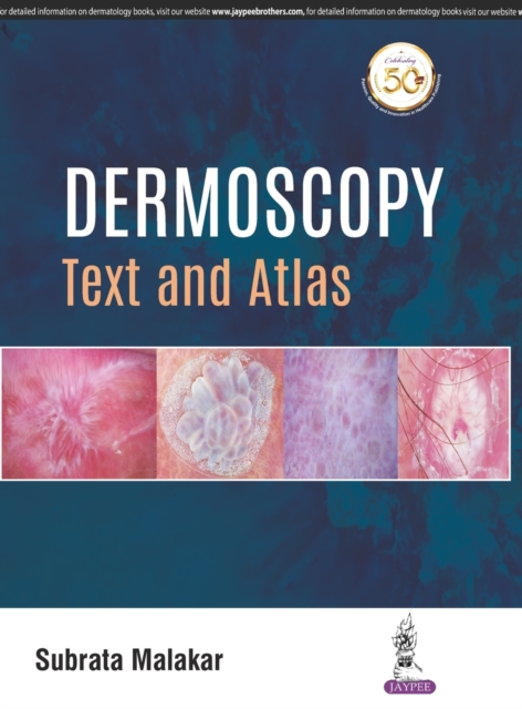 Dermoscopy : Text and Atlas, Hardback Book