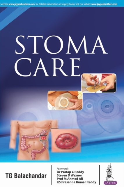 Stoma Care, Paperback / softback Book