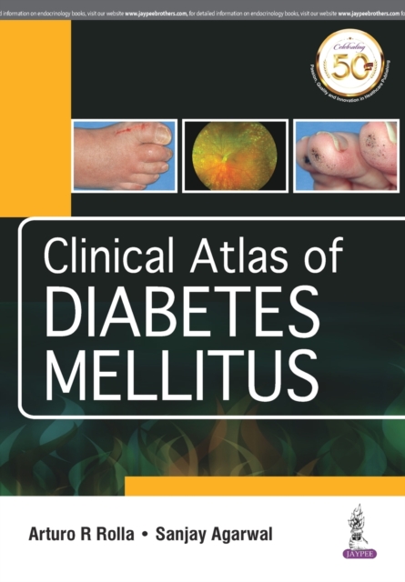 Clinical Atlas of Diabetes Mellitus, Paperback / softback Book