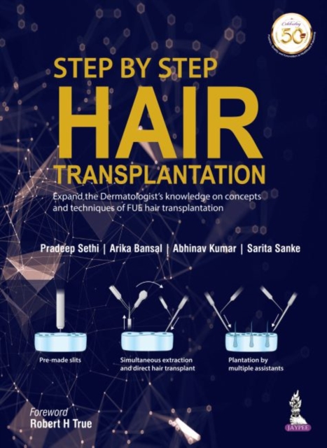 Step by Step Hair Transplantation, Paperback / softback Book