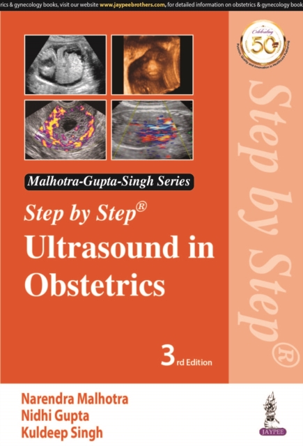 Step by Step Ultrasound in Obstetrics, Paperback / softback Book