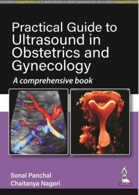 Practical Guide to Ultrasound in Obstetrics and Gynecology : A Comprehensive Book, Paperback / softback Book