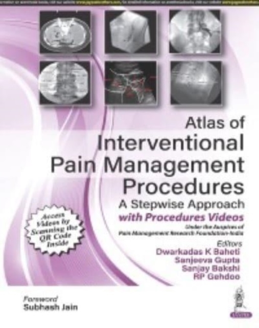 Atlas of Interventional Pain Management Procedures : A Stepwise Approach, Hardback Book