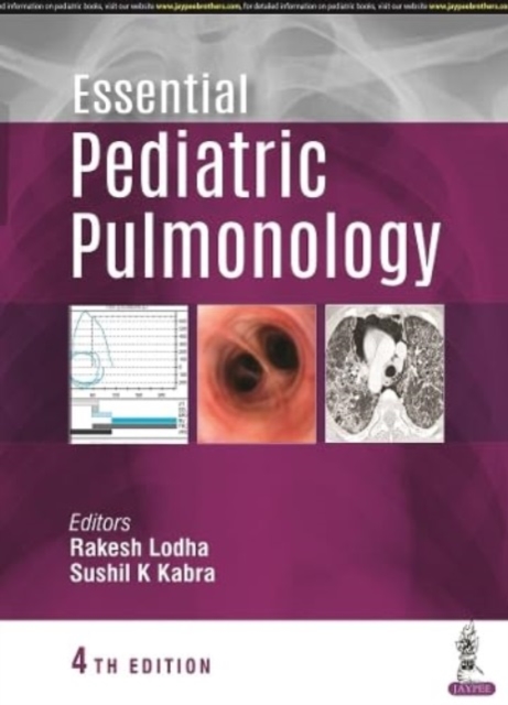 Essential Pediatric Pulmonology, Paperback / softback Book