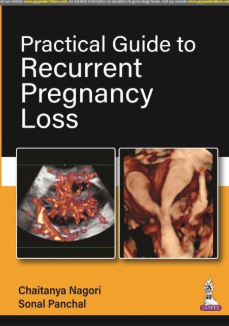 Practical Guide to Recurrent Pregnancy Loss, Paperback / softback Book