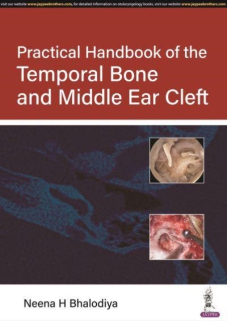Practical Handbook of the Temporal Bone and Middle Ear Cleft, Paperback / softback Book