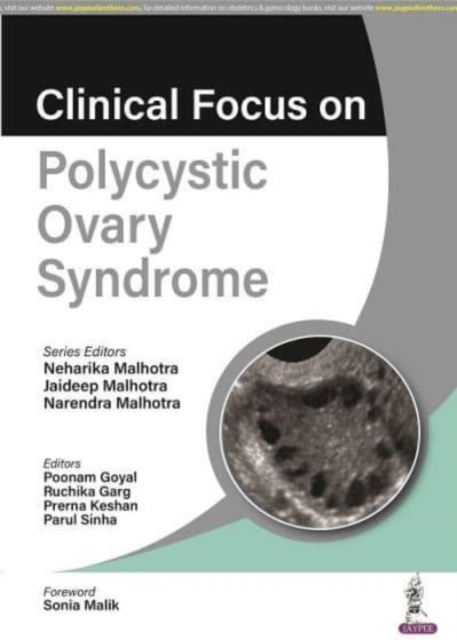 Clinical Focus on Polycystic Ovary Syndrome, Paperback / softback Book