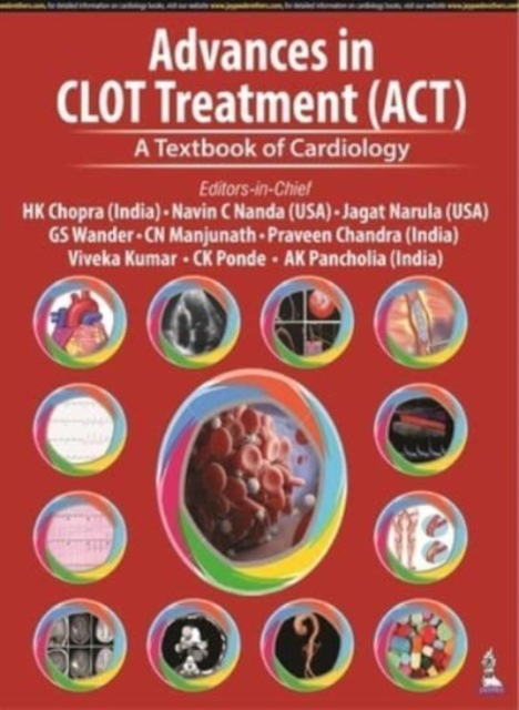 Advances in CLOT Treatment (ACT) : A Textbook of Cardiology, Hardback Book