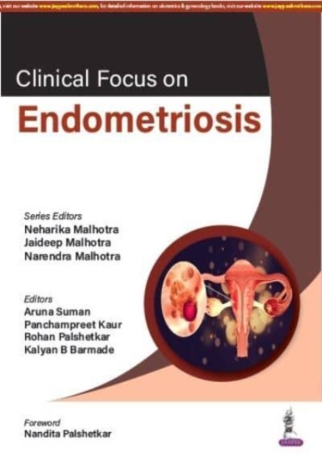 Clinical Focus on Endometriosis, Paperback / softback Book