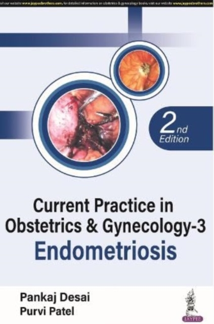 Current Practice in Obstetrics & Gynecology - 3 : Endometriosis, Paperback / softback Book