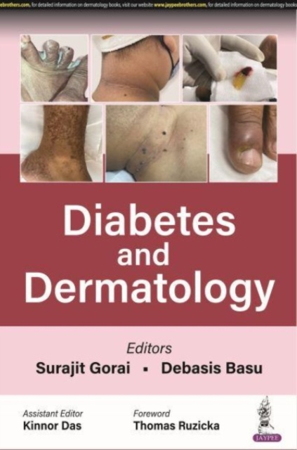 Diabetes and Dermatology, Paperback / softback Book