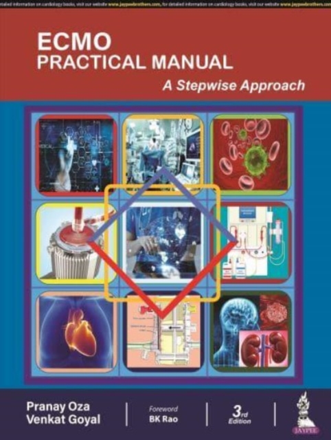 ECMO Practical Manual : A Stepwise Approach, Hardback Book