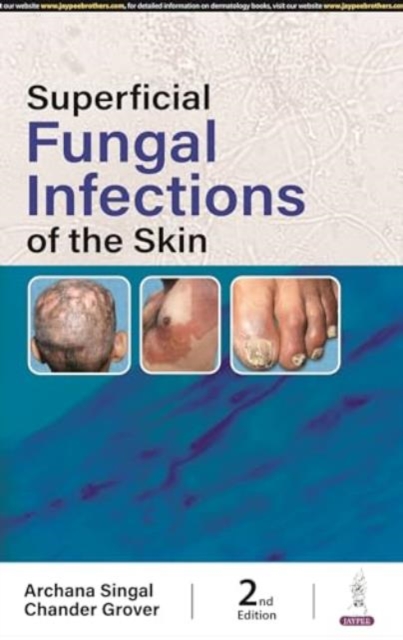 Superficial Fungal Infections of the Skin, Paperback / softback Book