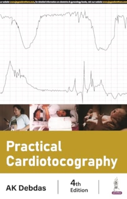 Practical Cardiotocography, Paperback / softback Book