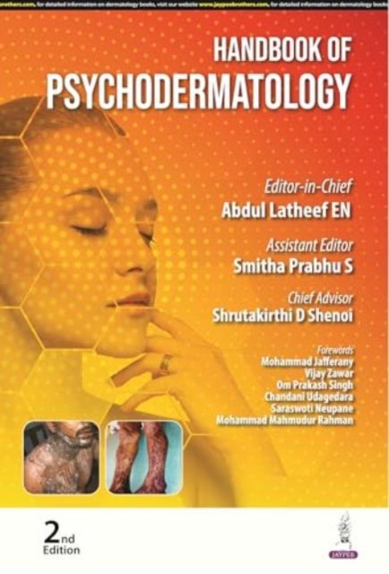 Handbook of Psychodermatology, Paperback / softback Book