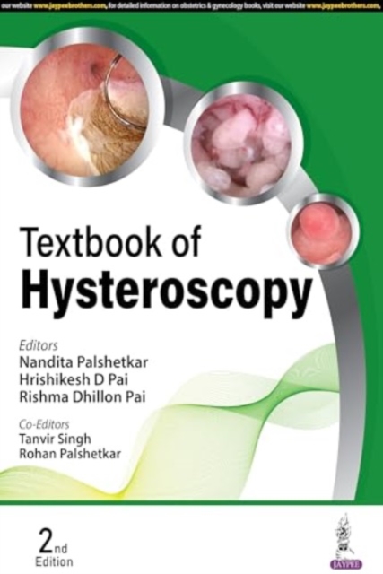 Textbook of Hysteroscopy, Hardback Book