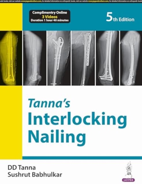Tanna’s Interlocking Nailing, Paperback / softback Book