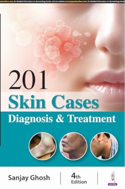 201 Skin Cases : Diagnosis & Treatment, Paperback / softback Book