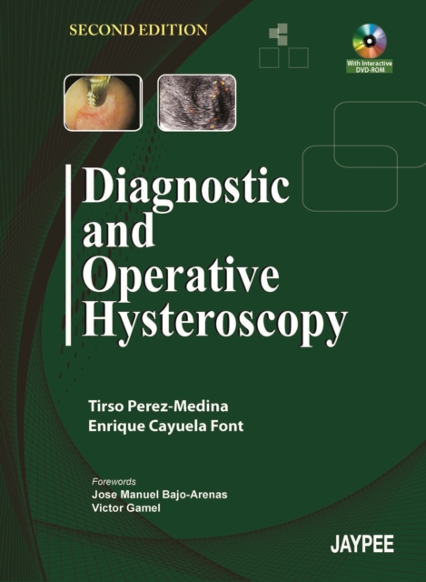 Diagnostic and Operative Hysteroscopy, Mixed media product Book