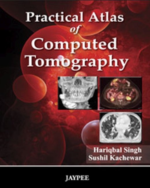 Practical Atlas of Computed Tomography, Hardback Book