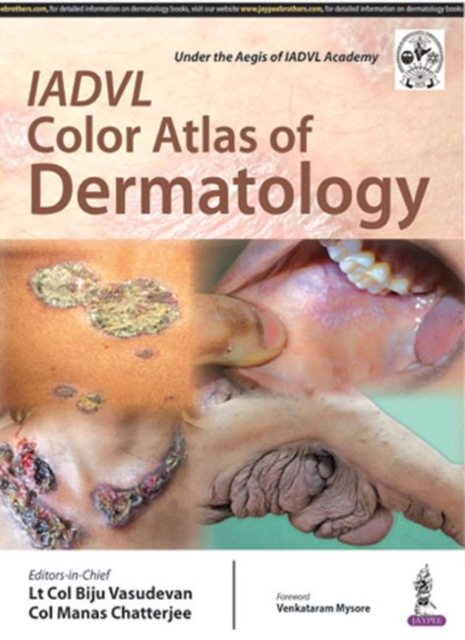 IADVL Color Atlas of Dermatology, Hardback Book