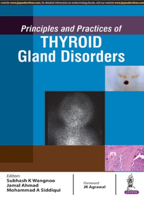 Principles and Practices of Thyroid Gland Disorders, Hardback Book
