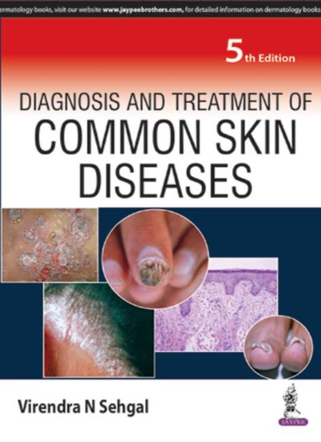 Diagnosis and Treatment of Common Skin Diseases, Paperback / softback Book