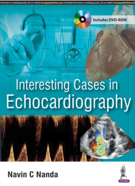 Interesting Cases in Echocardiography, Paperback / softback Book