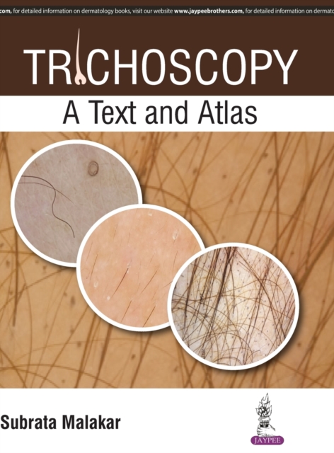 Trichoscopy : A Text and Atlas, Hardback Book
