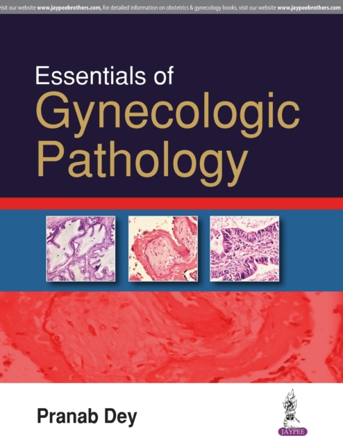 Essentials of Gynecologic Pathology, Paperback / softback Book