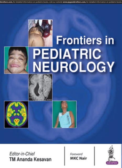 Frontiers in Pediatric Neurology, Paperback / softback Book