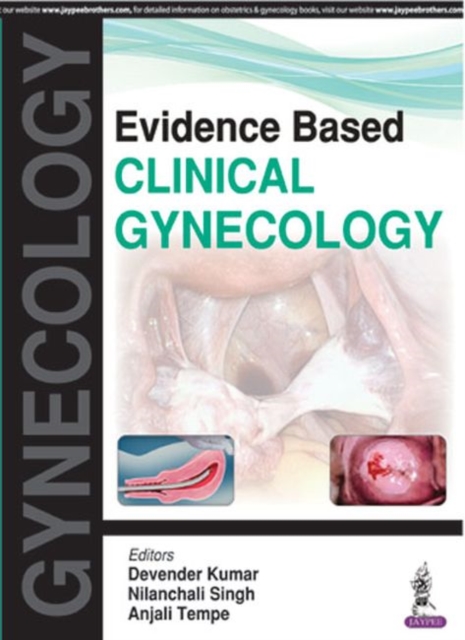 Evidence Based Clinical Gynecology, Paperback / softback Book