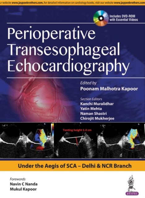 Perioperative Transeasophageal Echocardiography, Hardback Book