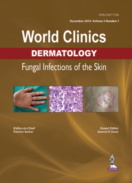 World Clinics Dermatology: Fungal Infections of the Skin : Volume 3, Number 1, Hardback Book