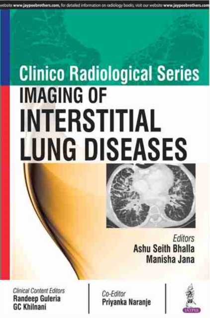 Clinico Radiological Series: Imaging of Interstitial Lung Diseases, Paperback / softback Book
