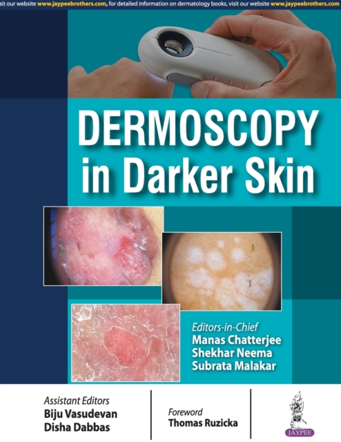 Dermoscopy in Darker Skin, Paperback / softback Book