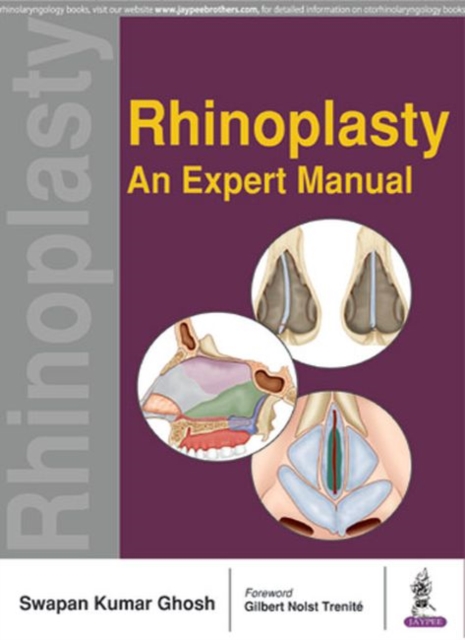 Rhinoplasty : An Expert Manual, Paperback / softback Book