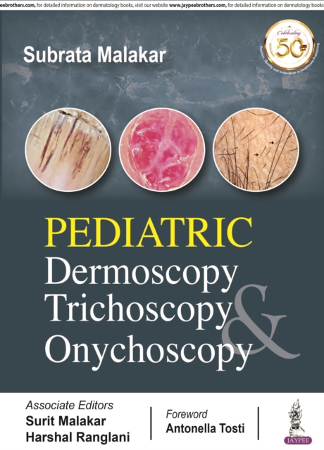 Pediatric Dermoscopy Trichoscopy & Onychoscopy, Paperback / softback Book
