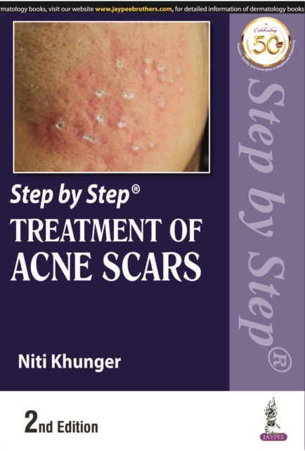 Step by Step Treatment of Acne Scars, Paperback / softback Book