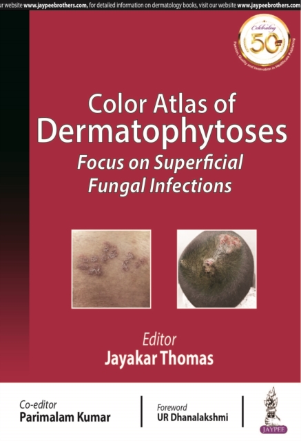 Color Atlas of Dermatophytoses : Focus on Superficial Fungal Infections, Paperback / softback Book