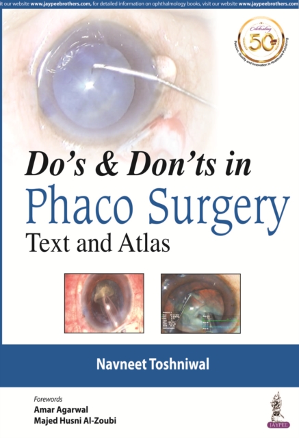 Do's & Dont's in Phaco Surgery : Text and Atlas, Hardback Book
