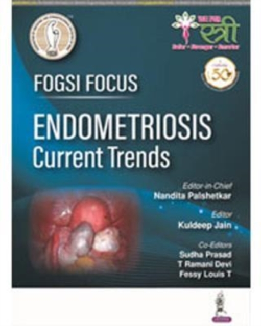 FOGSI Focus Endometriosis: Current Trends, Paperback / softback Book