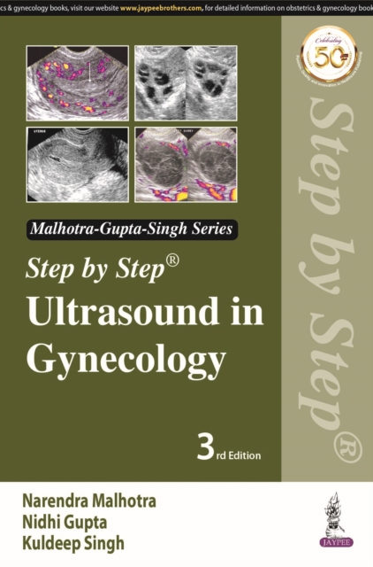 Step by Step Ultrasound in Gynecology, Paperback / softback Book
